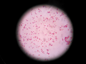 显微镜下的大肠杆菌