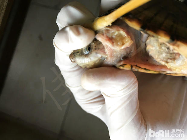 一例剃刀龟颈部肿瘤的切除报告