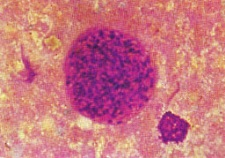 养宠家庭如何预防弓形虫病 养宠家庭如何预防弓形虫病