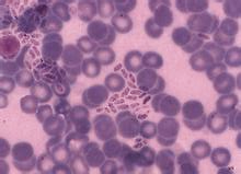 养宠家庭如何预防弓形虫病 养宠家庭如何预防弓形虫病